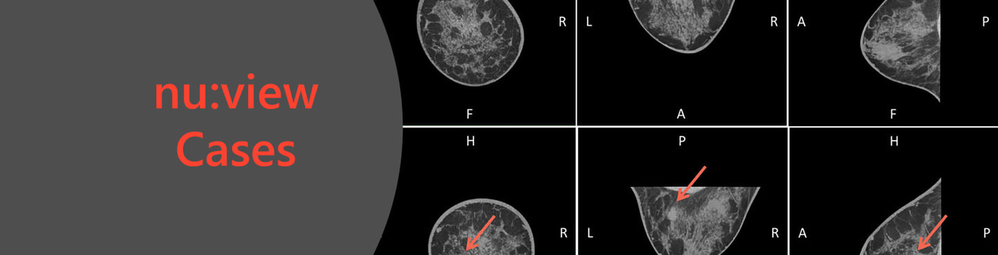 nu:viewの臨床症例