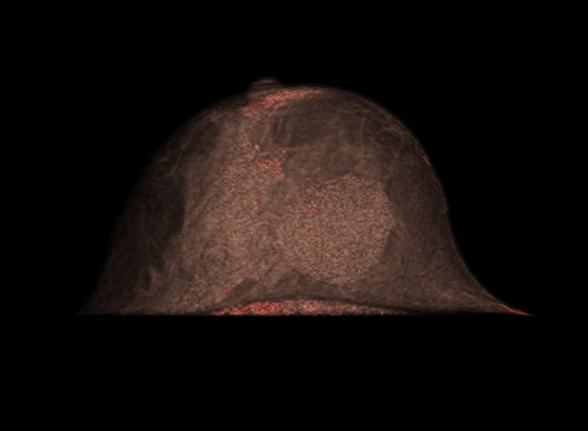 臨床症例画像03