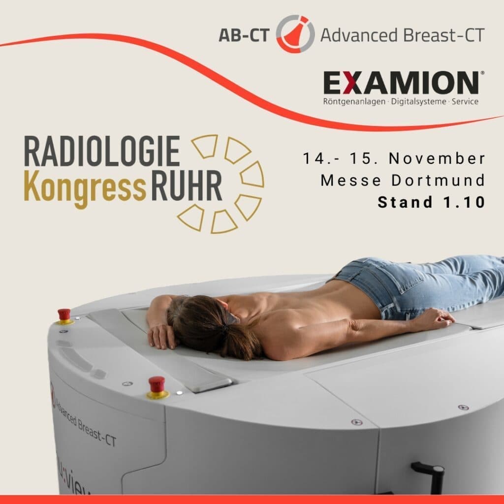 乳房密度に関する新たな研究